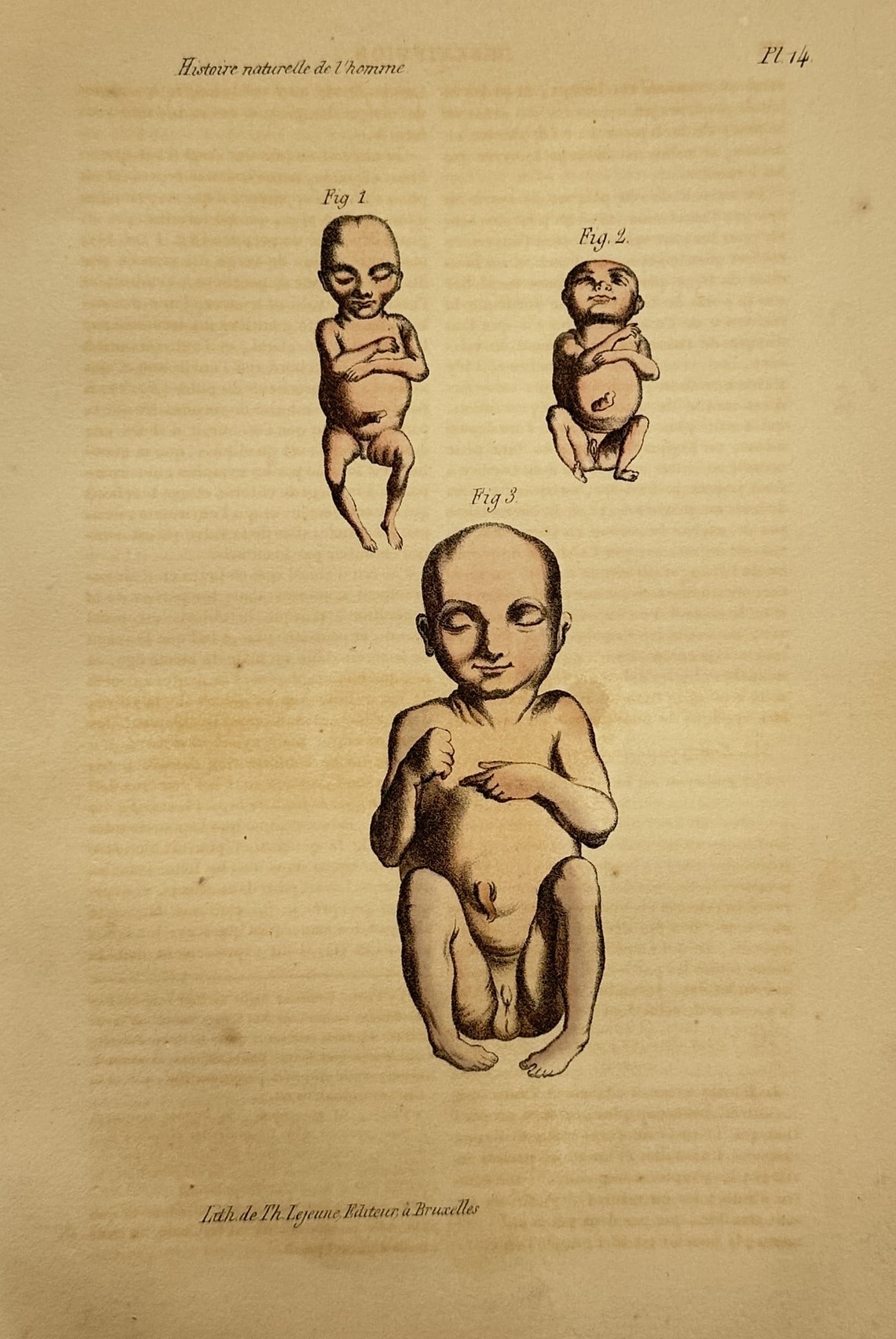 Theodore Lejeune – Anatomical Study of Human Fetal Development – Hand-coloured lithograph (1 of 2)