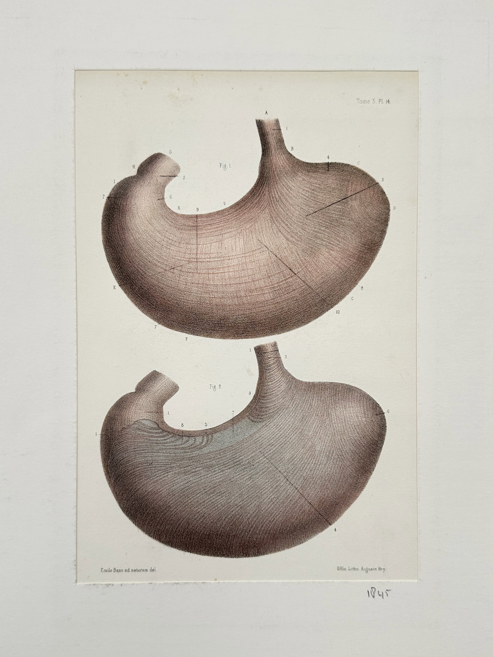 Auguste Bry (1805–1880) – Anatomical Study of the Stomach – Lithograph (1845) (1 of 2)