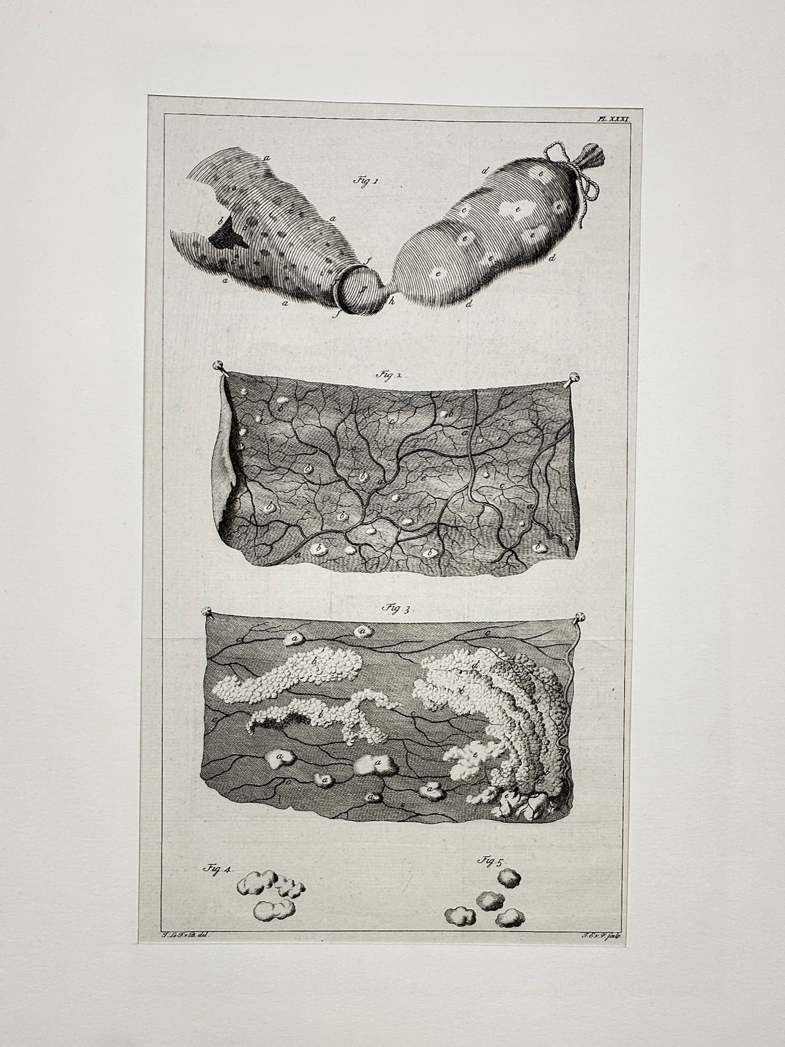 Frederik Ruysch (1638–1731) – View of an Anatomical and Medical Study – Engraving (1721) (1 of 2)