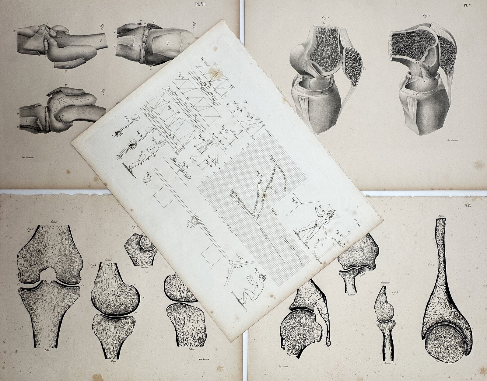 Various Artists – Set of 5: Orthopedic Osteology and Mechanical Biomechanics (1 of 2)