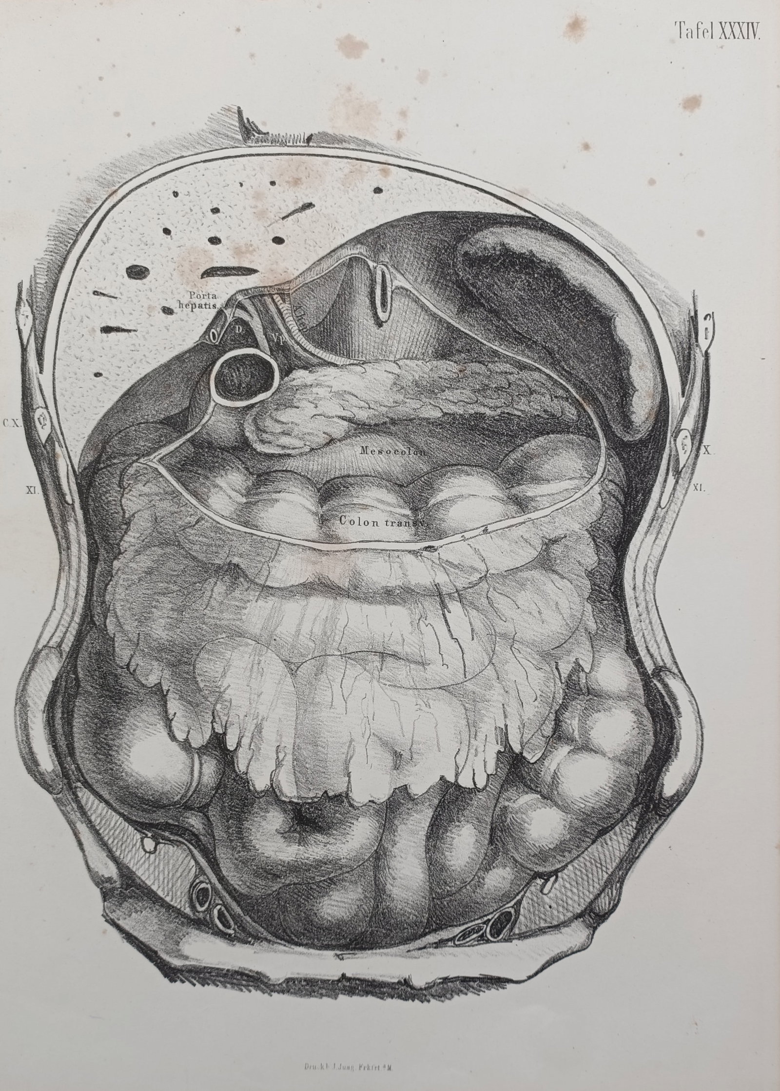 Wilhelm von Henke (1834–1896) – Anatomical Study of the Human Abdomen – Lithograph (1867) (1 of 2)