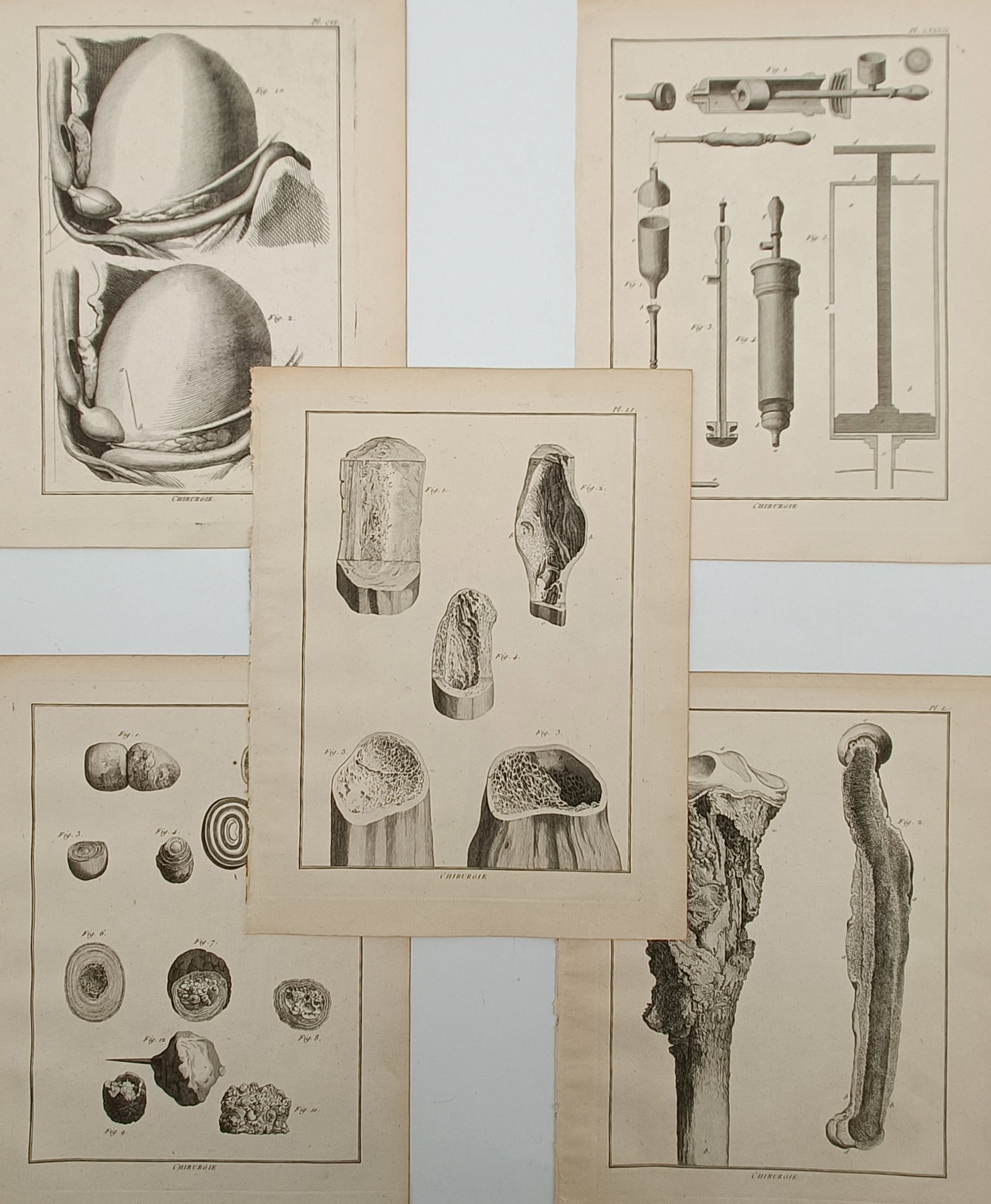 Robert Bénard – Set of 5: Surgical and Pathological Studies of Human Anatomy and Medical (1 of 2)