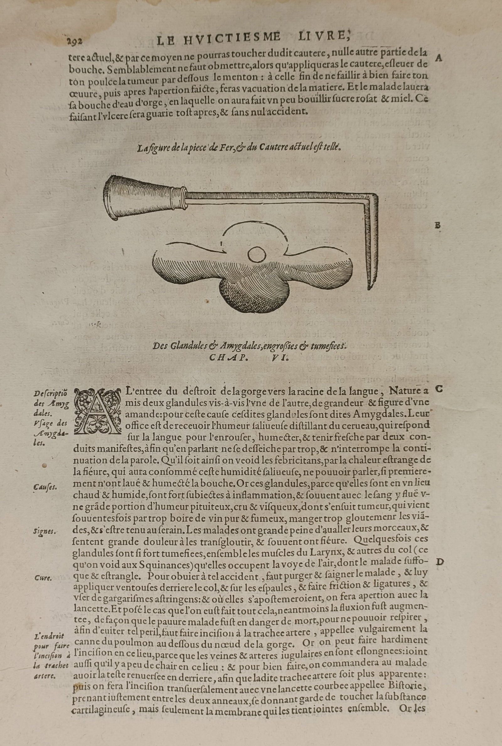Ambroise Paré – Surgical Study of Medical Instruments – Woodcut (1575): "Le Hvictiesme Livre" This work consists of a medical print displaying detailed historical illustrations of a cautery iron and a clover-shaped surgical instrument set within a page of typography. The 