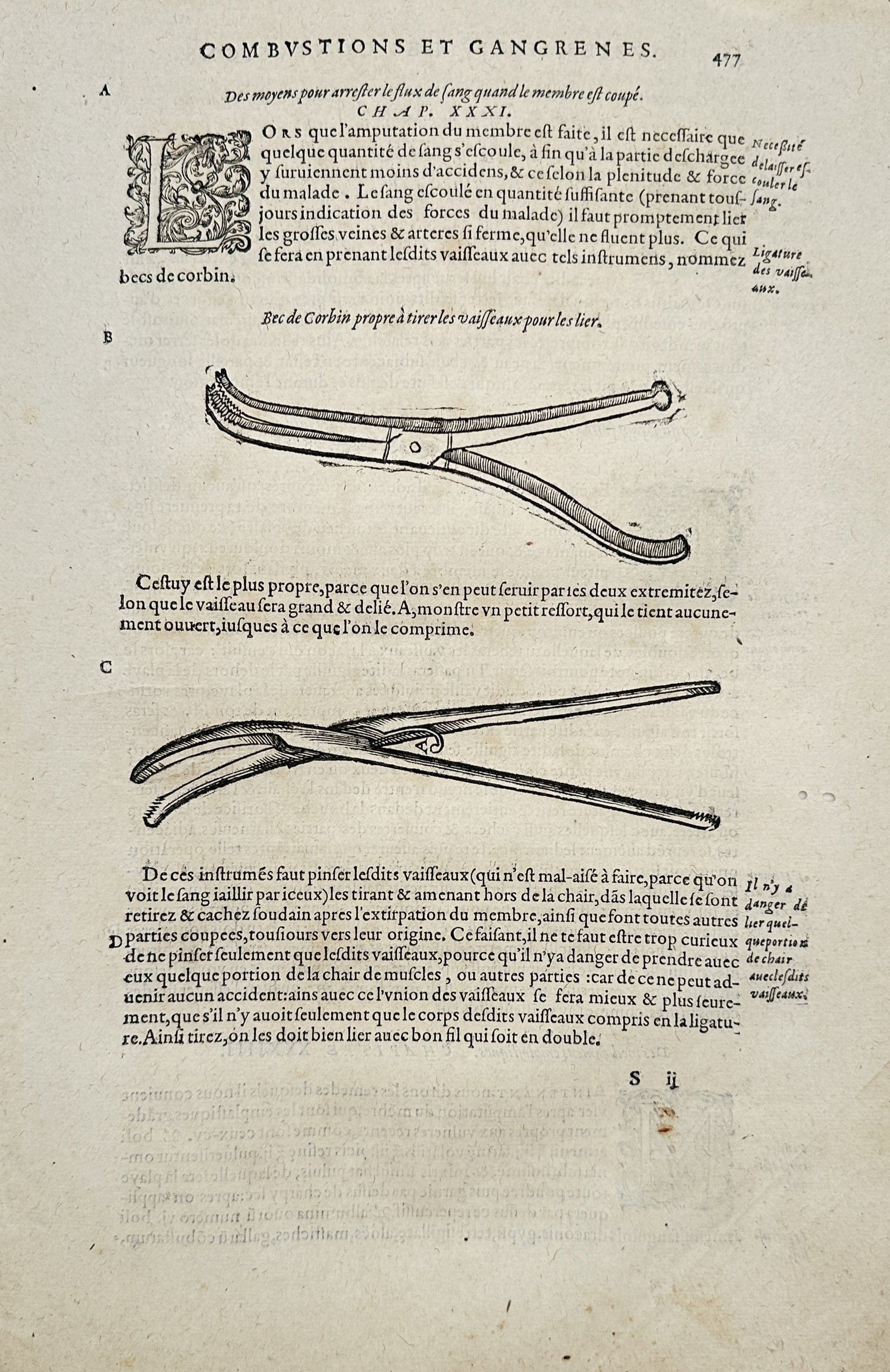 Ambroise Paré – Surgical Forceps for Vascular Ligation – Woodcut (16th Century) (1 of 2)