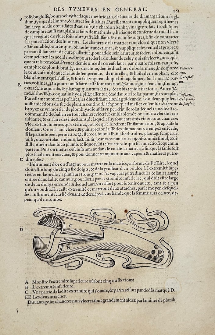 Ambroise Paré – Surgical Speculum for Tumors – Woodcut (16th Century) (1 of 2)