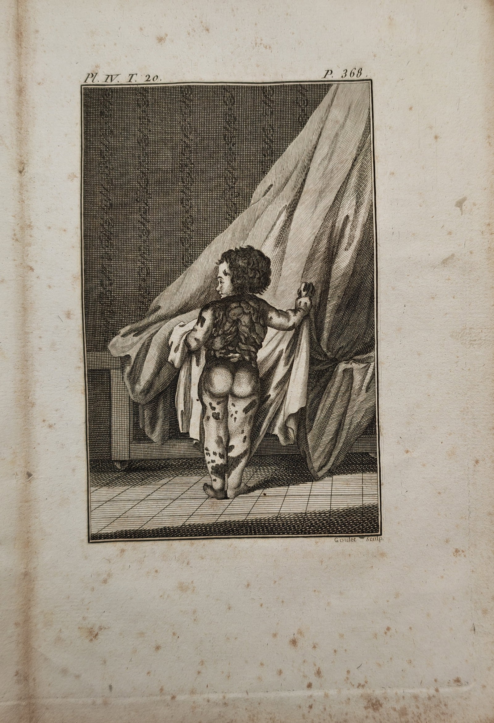 Georges-Louis Leclerc de Buffon – Piebald Child – Engraving (18th Century) (1 of 2)