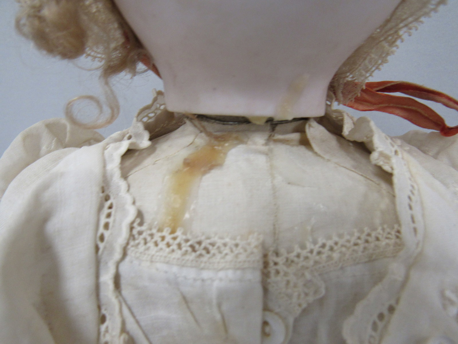 20 IN. STEINER WALKER: - 10