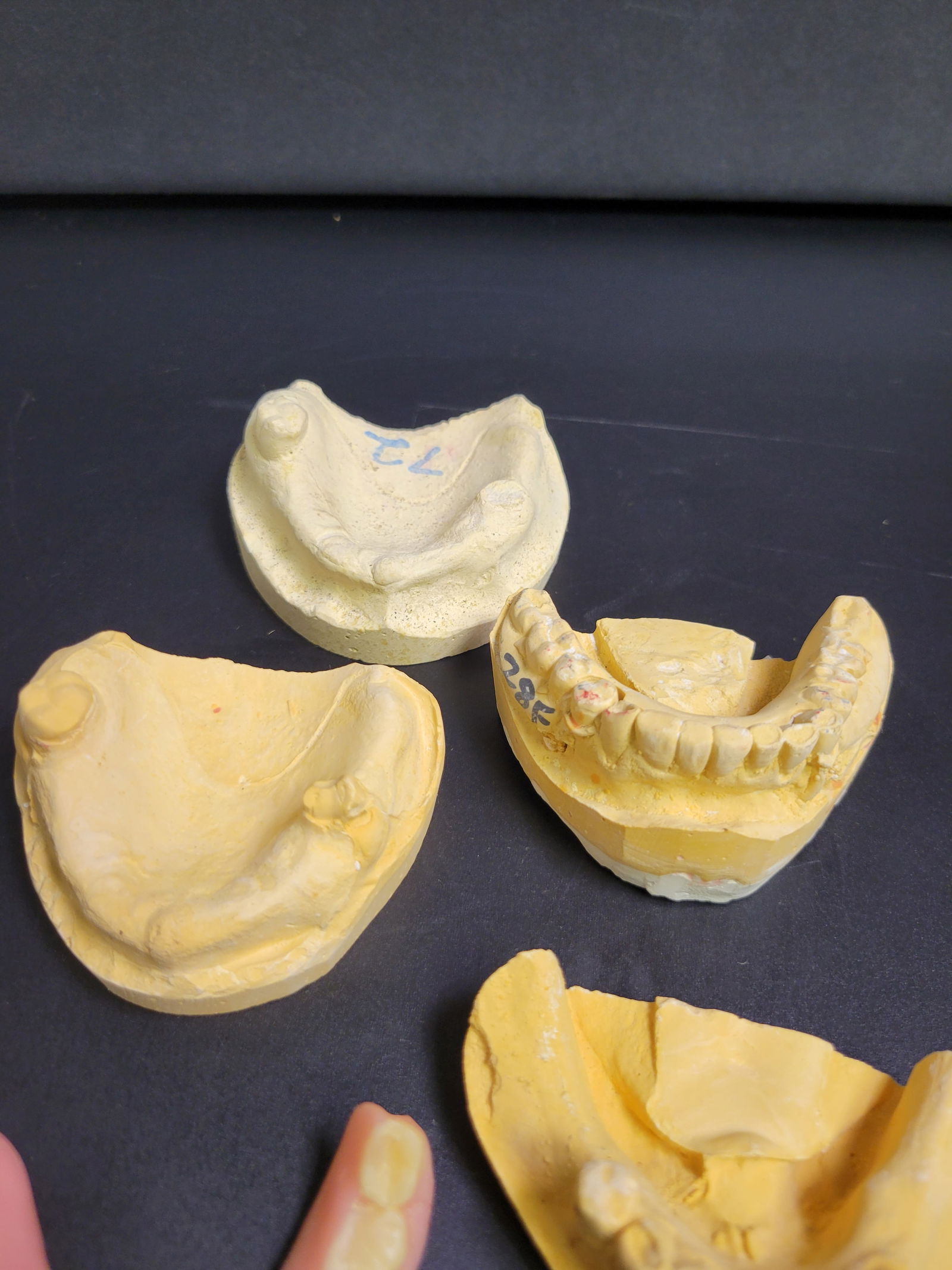 Teeth Mold Lot - 2
