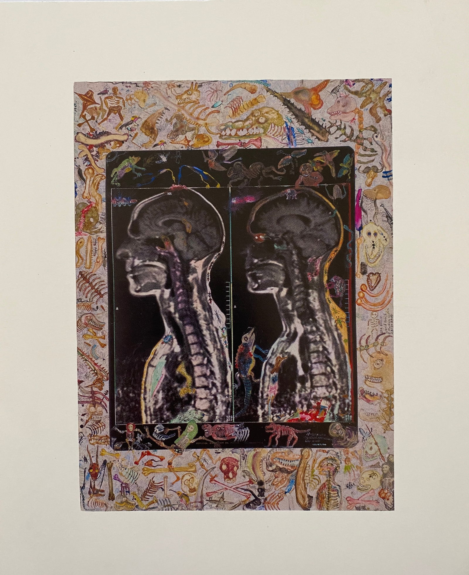 Peter Beard - MRI-IRM, 1996: PETER BEARD (1938–2020) MRI-IRM, 1996 Print 5 3/4" x 4 1/4"