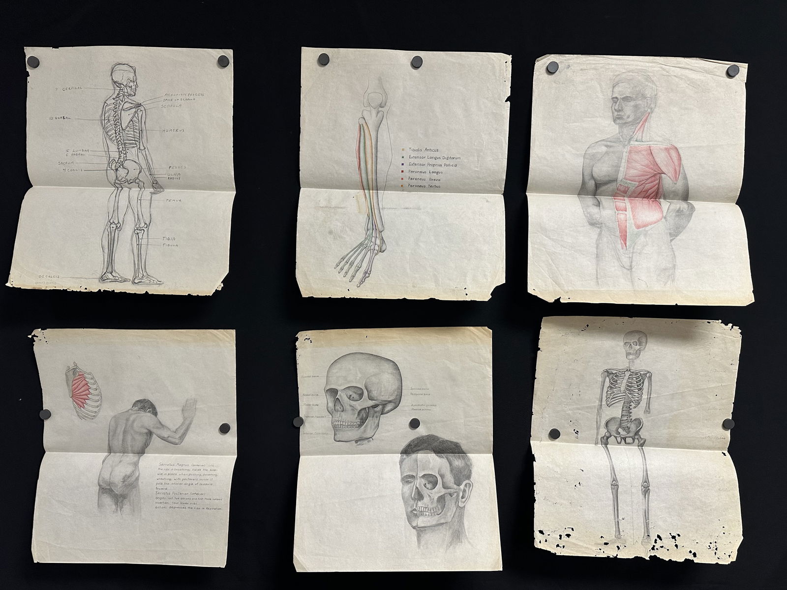 Set of Six Anatomical Drawings - Skeletons, Skulls (1 of 7)