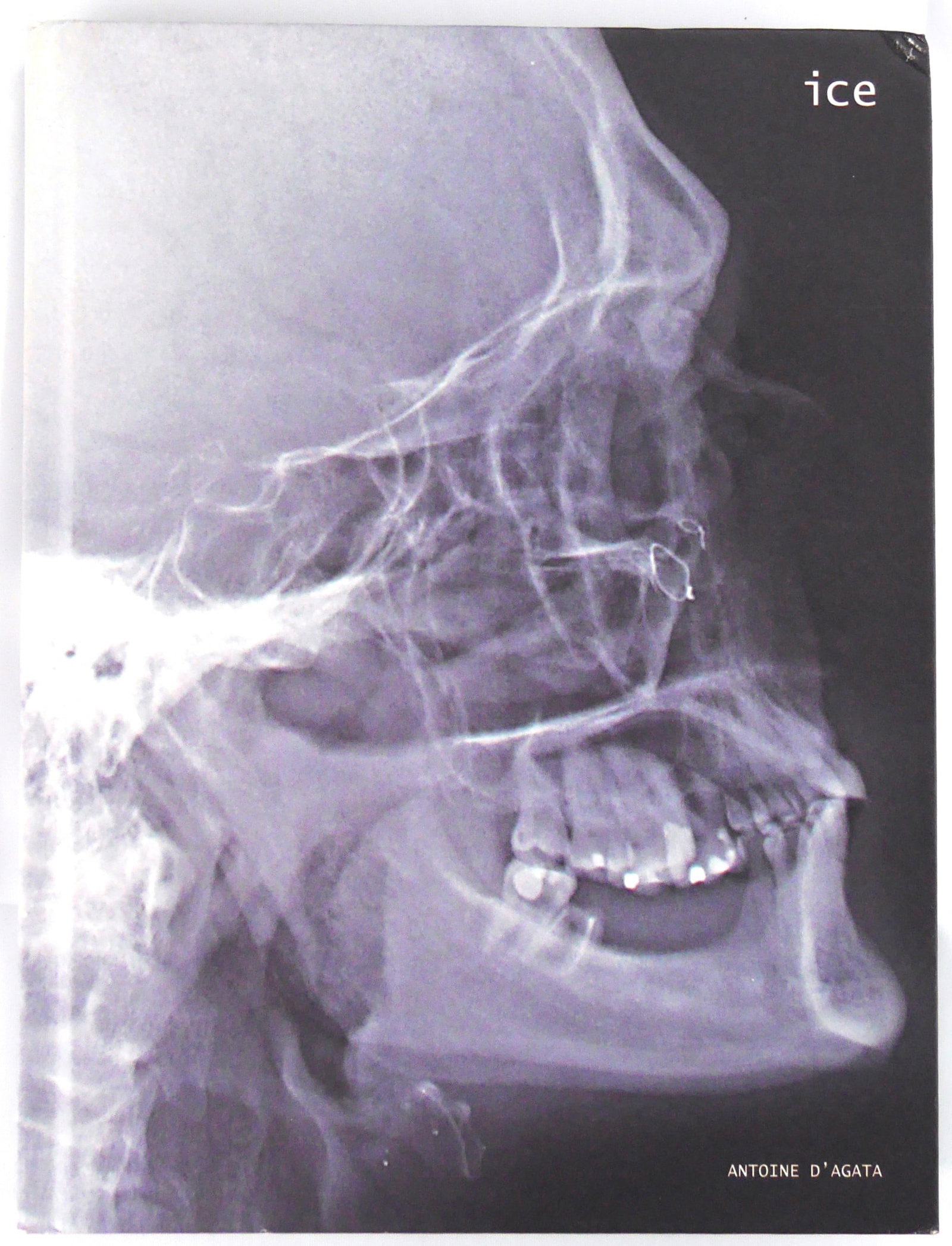 D'Agata, Antoine; Ice  [SIGNED] (1 of 5)