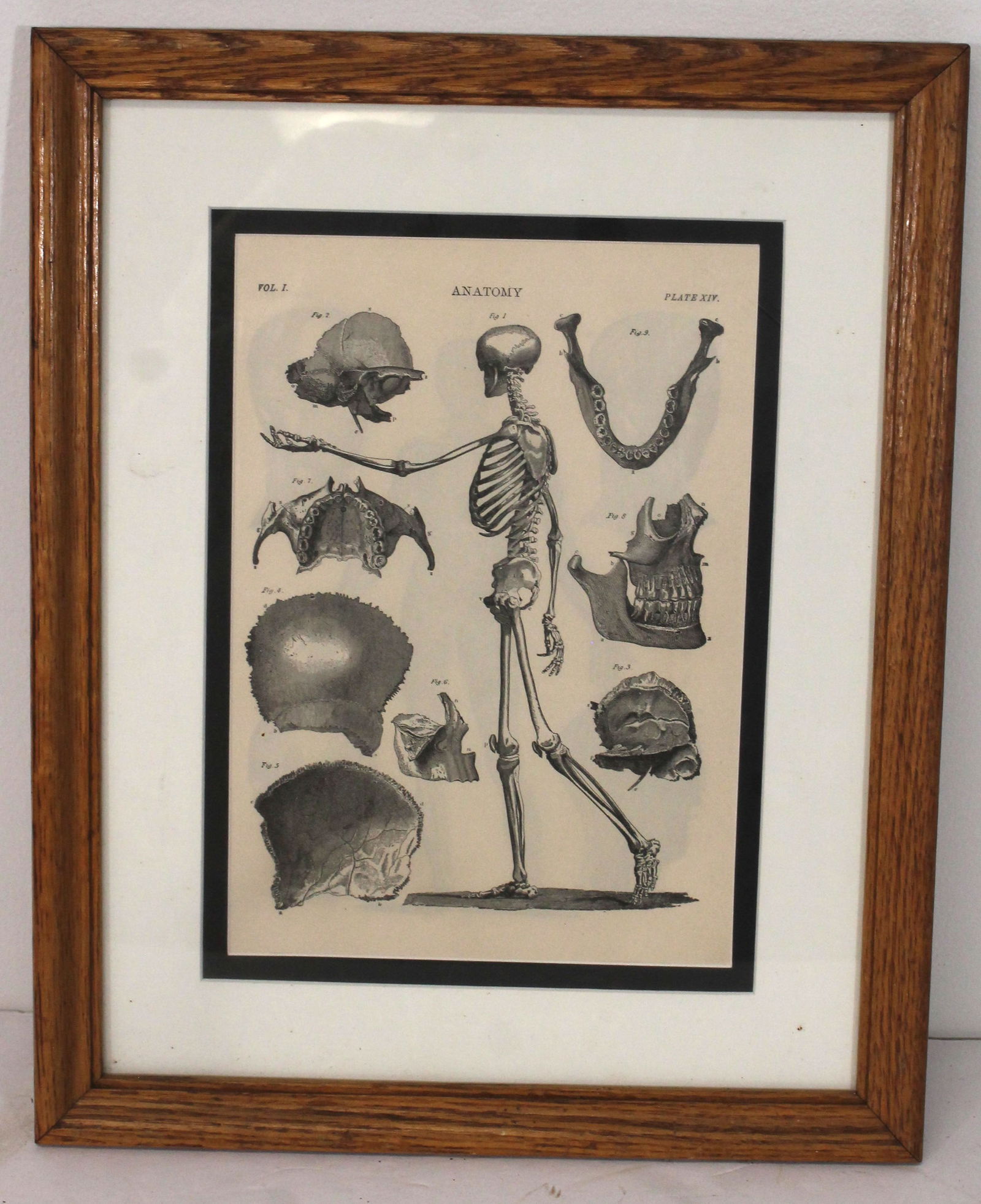 Framed book plate of anatomy skeleton - 15 1/2"x12 1/2" (1 of 4)