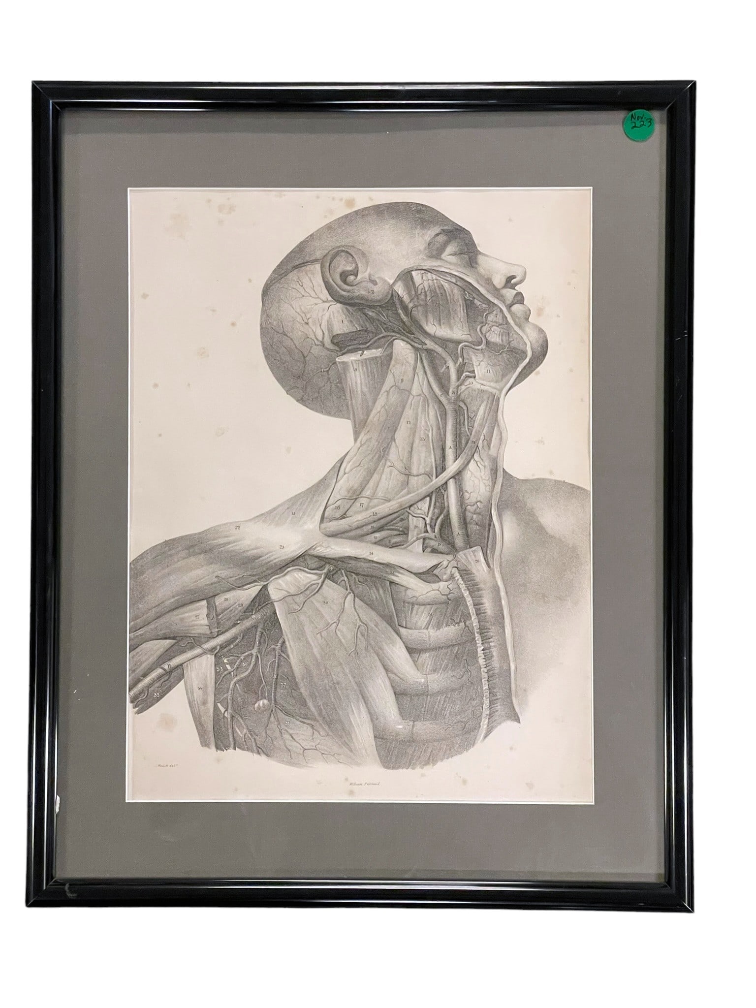 19th c W.FAIRLAND ANATOMICAL LITHOGRAPH (1 of 4)