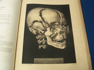 1840 TRAITE COMPLET DE L'ANATOMIE DE L'HOMME FRENCH VOLUME