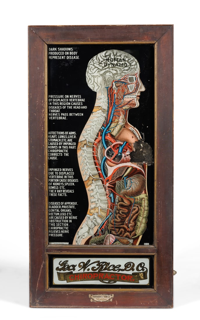 "Human Dynamo" Mechanical Chiropractor Trade Sign by Fairbanks Sign Co. (Jamestown, New York, ca. (1 of 7)