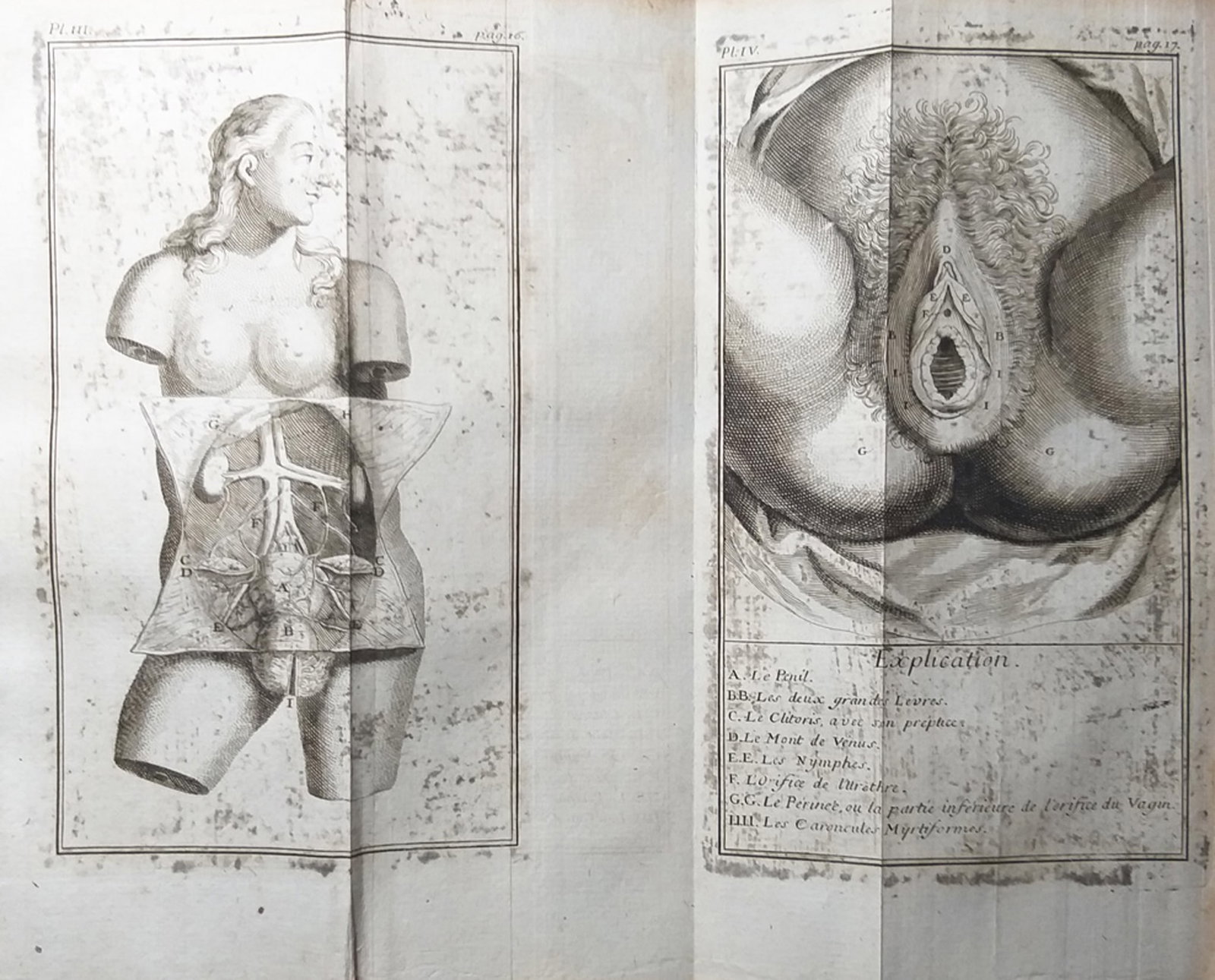 [SCIENCE AND MEDICINE] - BLONDEL Jacques (1705 - 1774) - 1737. The Imagination Of Pregnant Woman: Blondel, Jacques. "Dissertation physique sur la force de l’imagination des femmes enceintes sur le fetus. Traduit de l’Anglois par Albert Brun." Leyden: Langerak & Lucht, 173