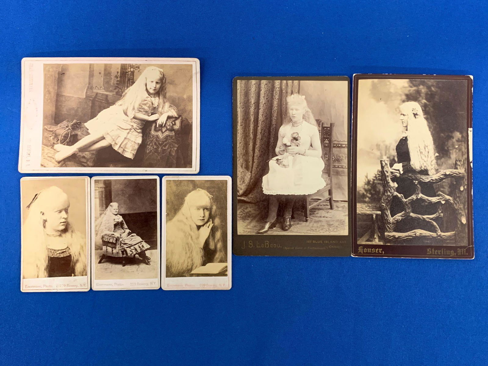 Six Cabinet Cards and CdVs of Albino Women (1 of 5)