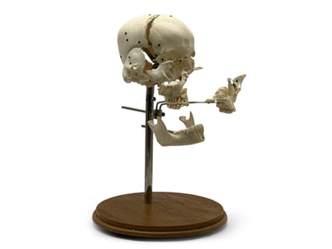 Beauchene Human Skull Specimen