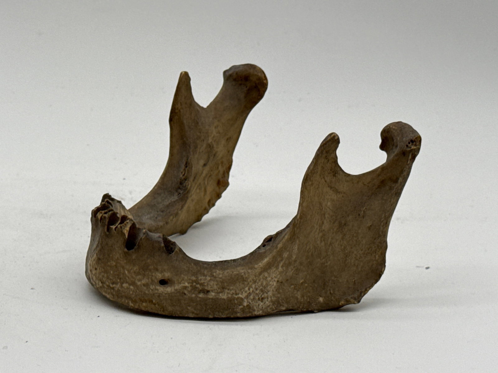 Human Medical Specimen Skull - 6