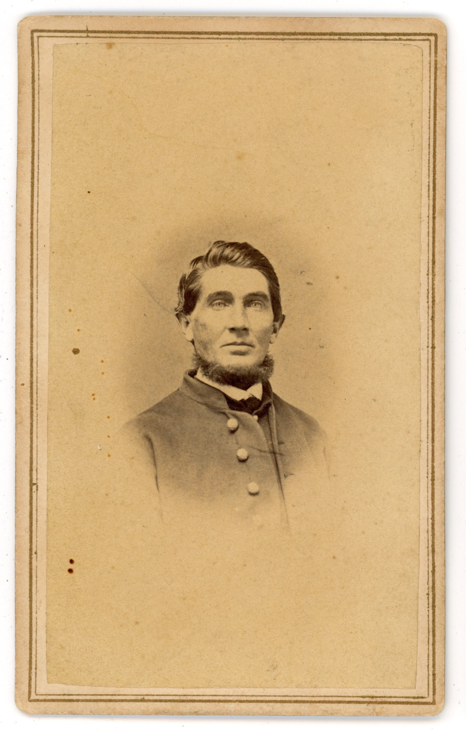 CDV Union Soldier Portrait N.B. Alworth Chico: Carte de visite portrait of an unidentified Union soldier shown in bust view, wearing a military coat with brass buttons. The image emphasizes the soldier’s youthful face and serious expression typi