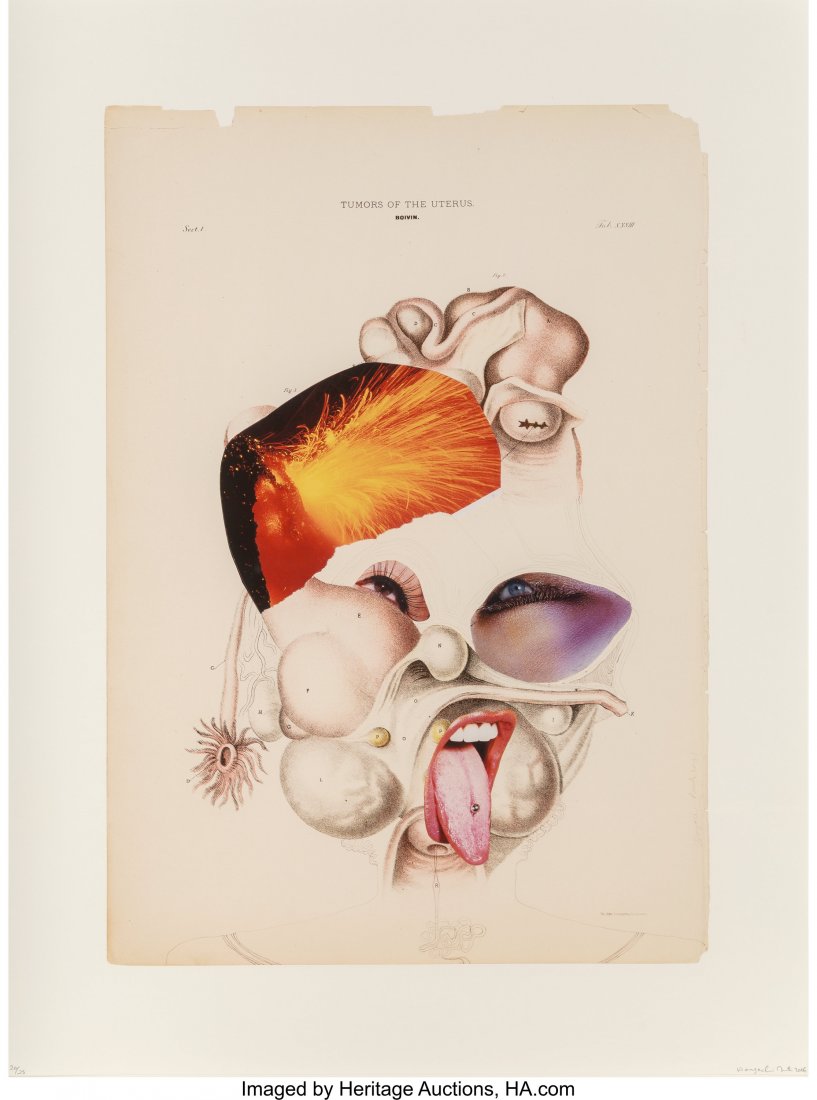 Wangechi Mutu (b. 1973) Histology of the Differe: Wangechi Mutu (b. 1973) Histology of the Different Classes of Uterine Tumors (12 works), 2006 Digital pigment prints and mixed media on paper 23 x 17 inches (58.4 x 43.2 cm) (sheet) (each) Ed. 20/25 E