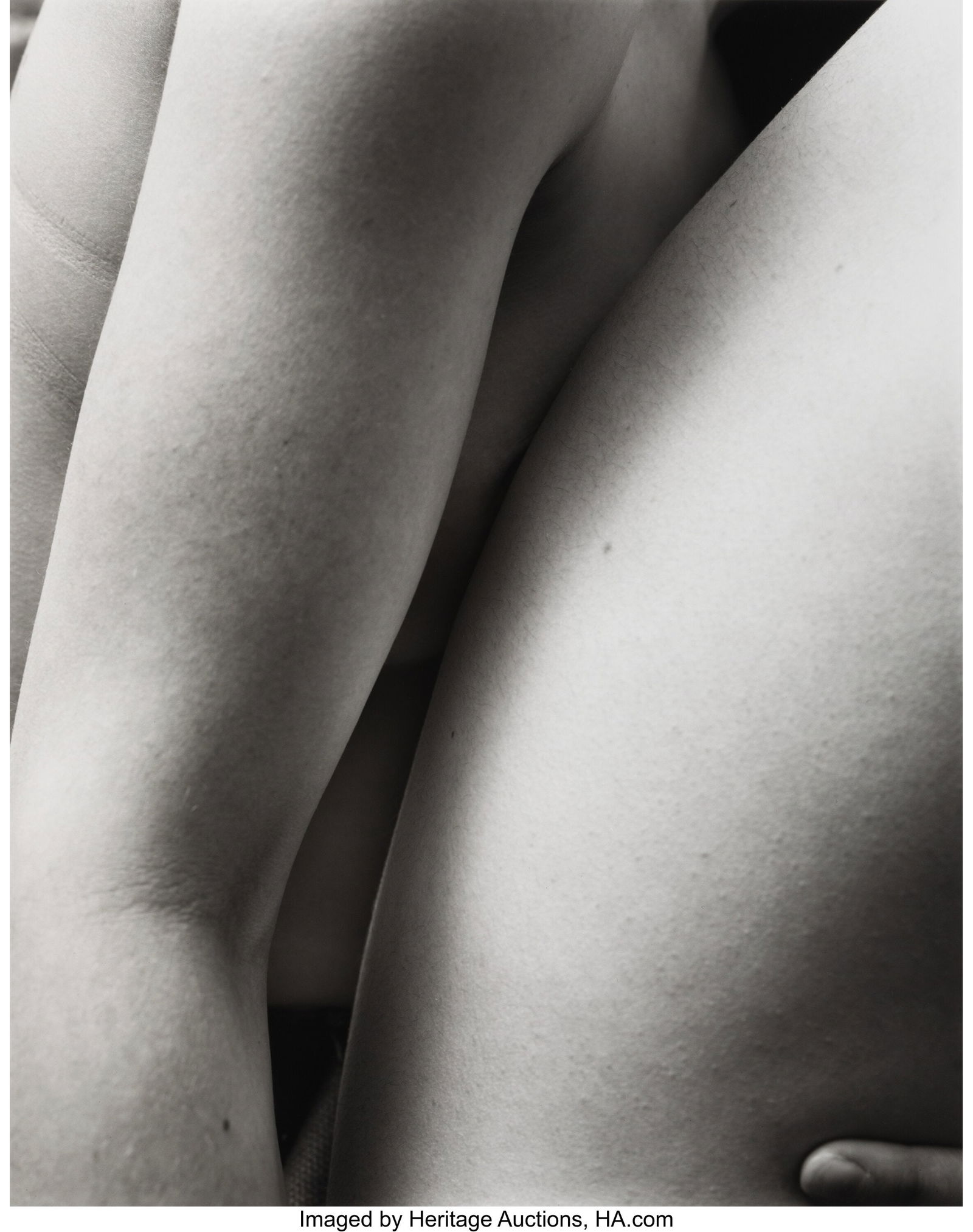 Nicholas Nixon (American, b. 1947) M.S. S.P: Nicholas Nixon (American, b. 1947) M.S. S.P., 2007 Gelatin silver print 28-1/2 x 22-1/4 inches (72.4 x 56.5 cm)