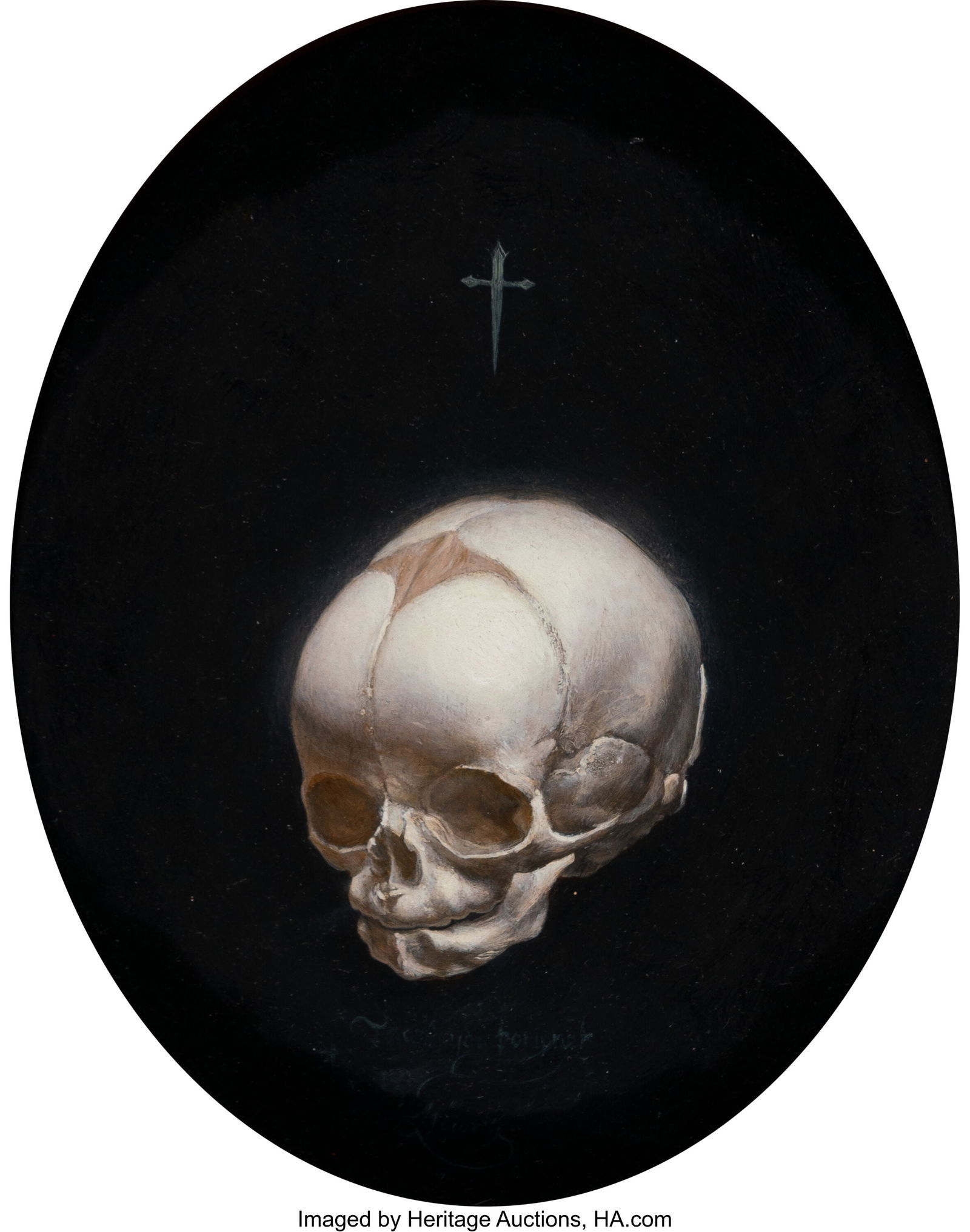 Unknown (20th Century) Untitled (Fetal skull) Oi (1 of 2)