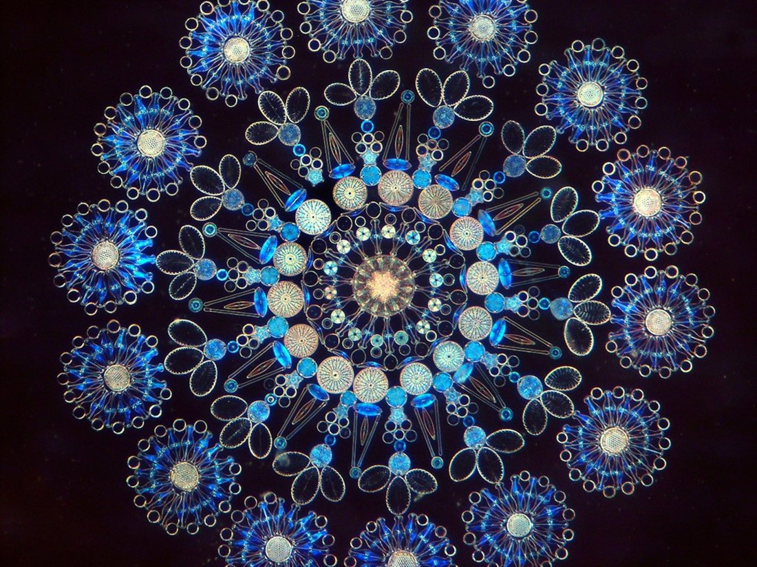 A Klaus D. Kemp Microscopic Picture Slide: Baske (1 of 6)