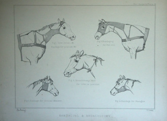 Benjamin Herring - Lithograph of Bandaging and Bronchotomy 1895 (1 of 1)