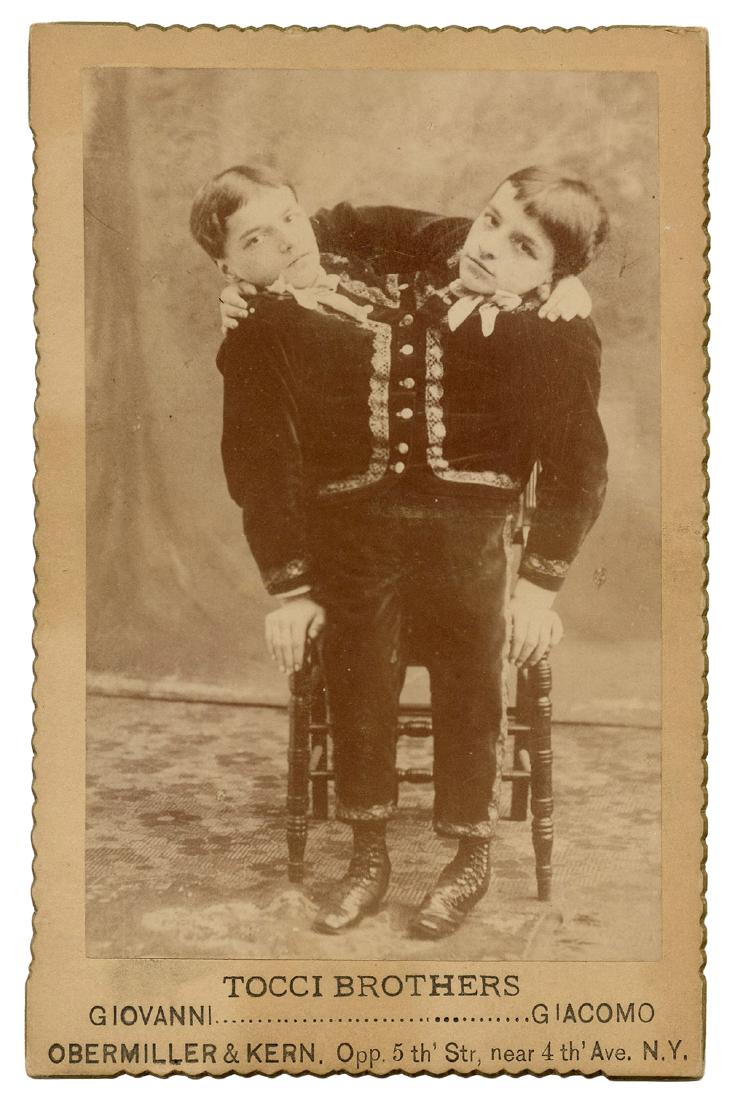 Tocci Brothers Siamese Twins Cabinet Card. (1 of 1)