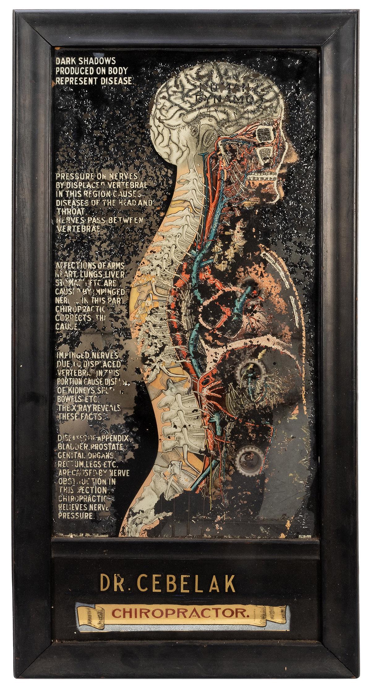 Dr. Cebelak Chiropractor Mechanical Advertising (1 of 2)