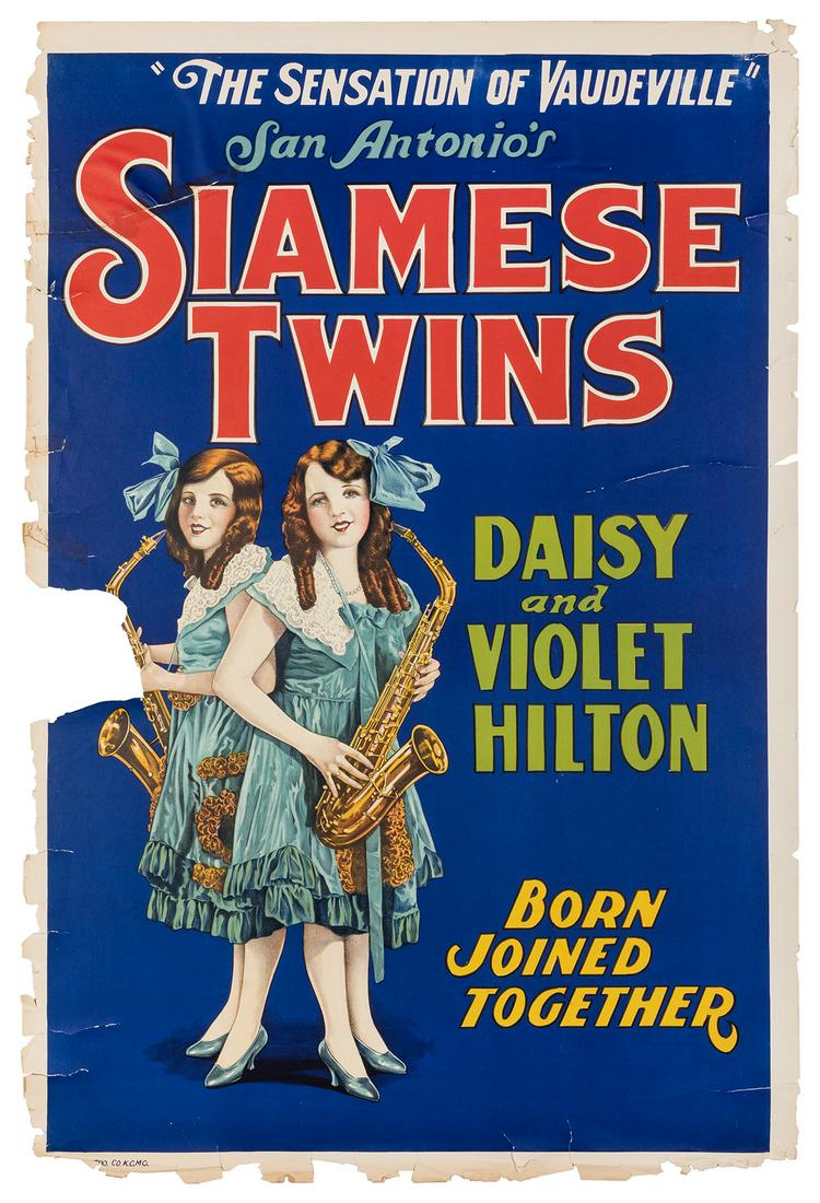 San Antonio’s Siamese Twins Daisy and Violet (1 of 1)
