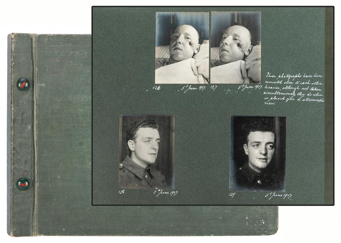 [ABNORMALITIES]. An album of 130 gruesome WWI photographs o... (1 of 8)