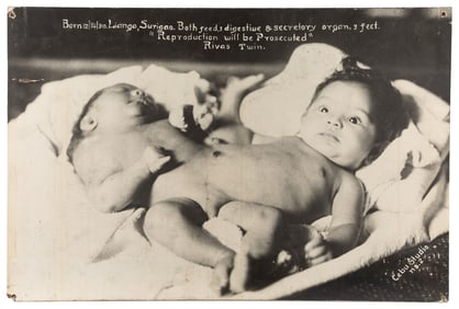 Siamese Twins Sideshow Lobby Board. Circa 1930s-40s. Photog...