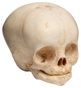 Human Fetal Skull. 20th century. Specimen of a full-term sk...