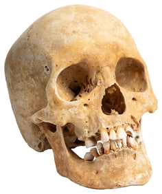 Human Skull. Mandible is loose from skull but is present. 2...