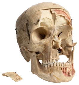 Human Skull. Skull is in 5 pieces for anatomical study purp...