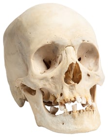Human Skull. Mandible is loose yet present. 12 teeth are st...