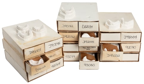 Group of 80 Plaster Dental Casts for an Orthodontist’s Offi...