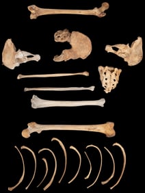Human Bones for Anatomical Study. Approximately 18 human bo...