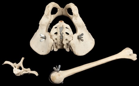 Human Bones for Anatomical Study. [Burlington, NC: Carolina...