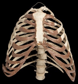 Human Ribcage with 13 Vertebrae. [N.p., n. d.] Near complet...