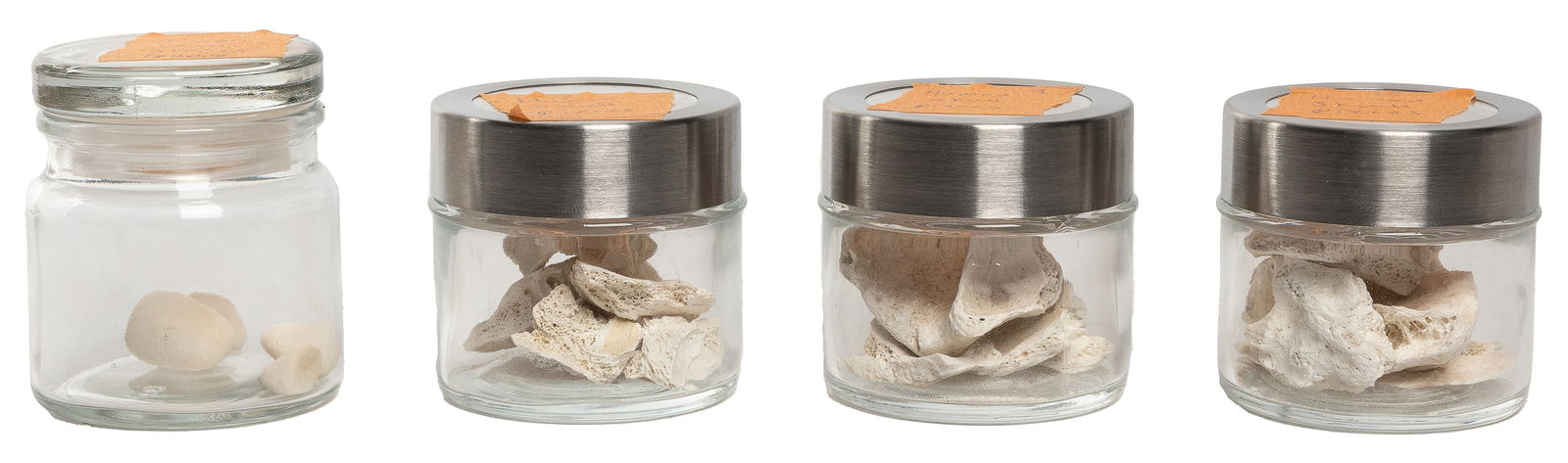 Human Skull Fragments and Gallstones. Small skull pieces (n... (1 of 1)