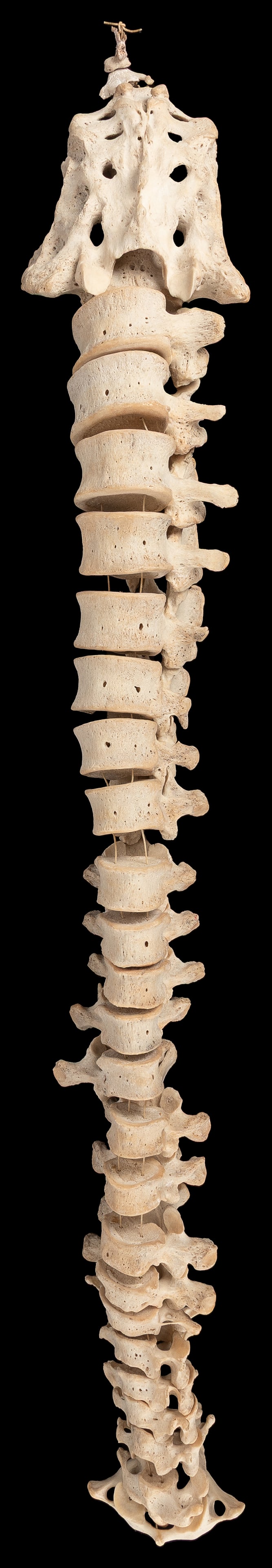 Human Spinal Column. Nearly complete (24 vertebrae plus sac... (1 of 2)