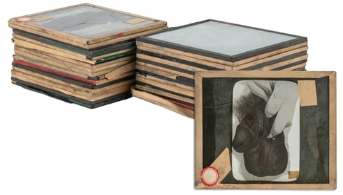 Group of Nearly 32 Glass Slides of Genital Deformities. [N....