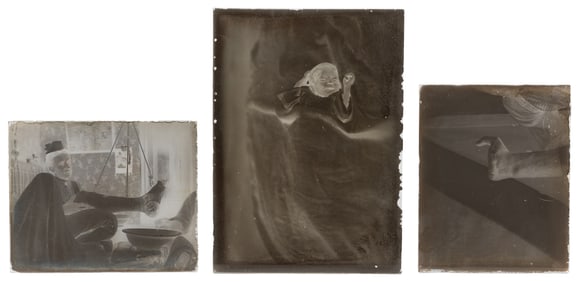 Three Glass Photo Negatives (Postmortem and Deformities). C...