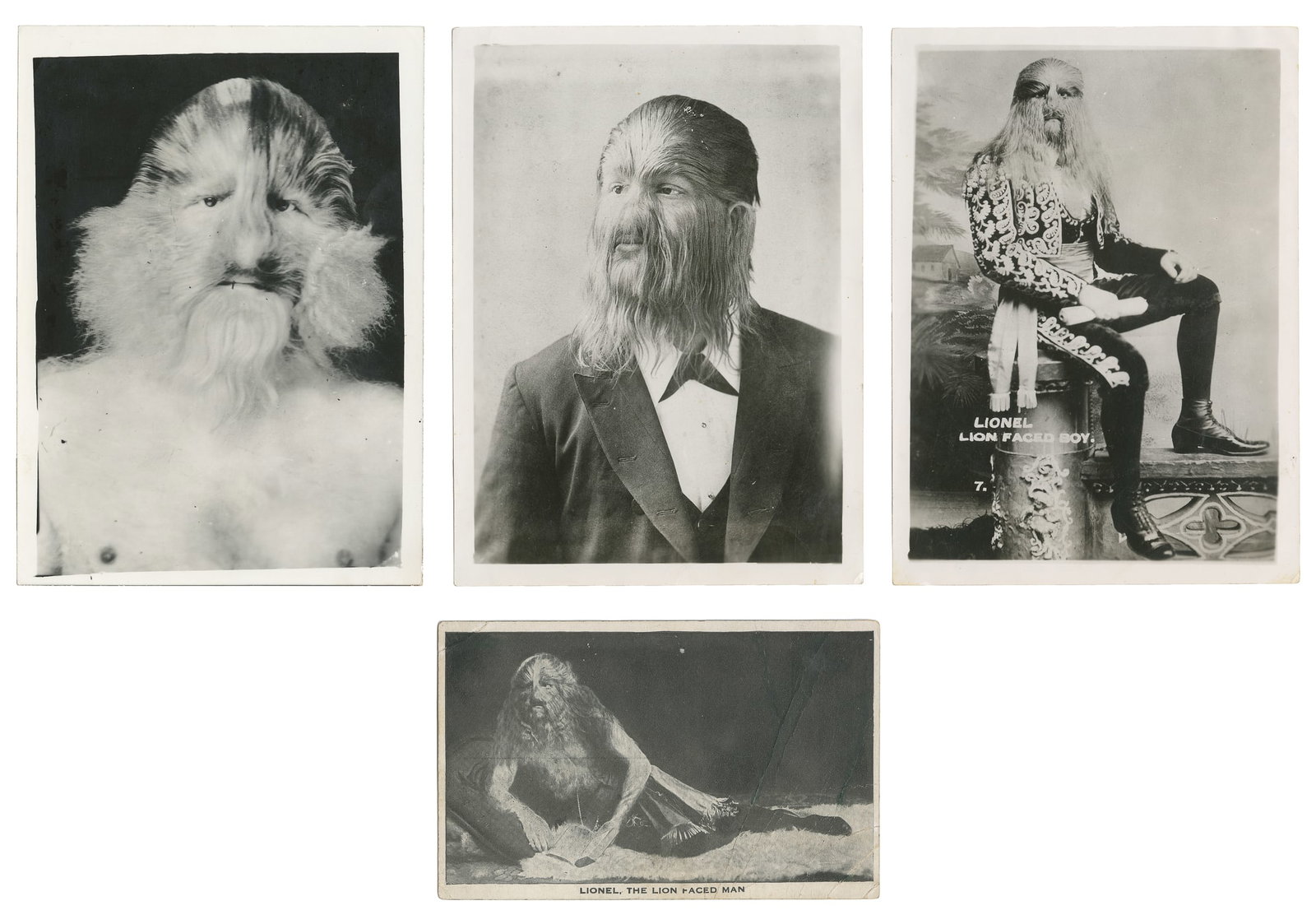 [SIDESHOW]. Group of 4 Kobel photos and a postcard. (1 of 2)