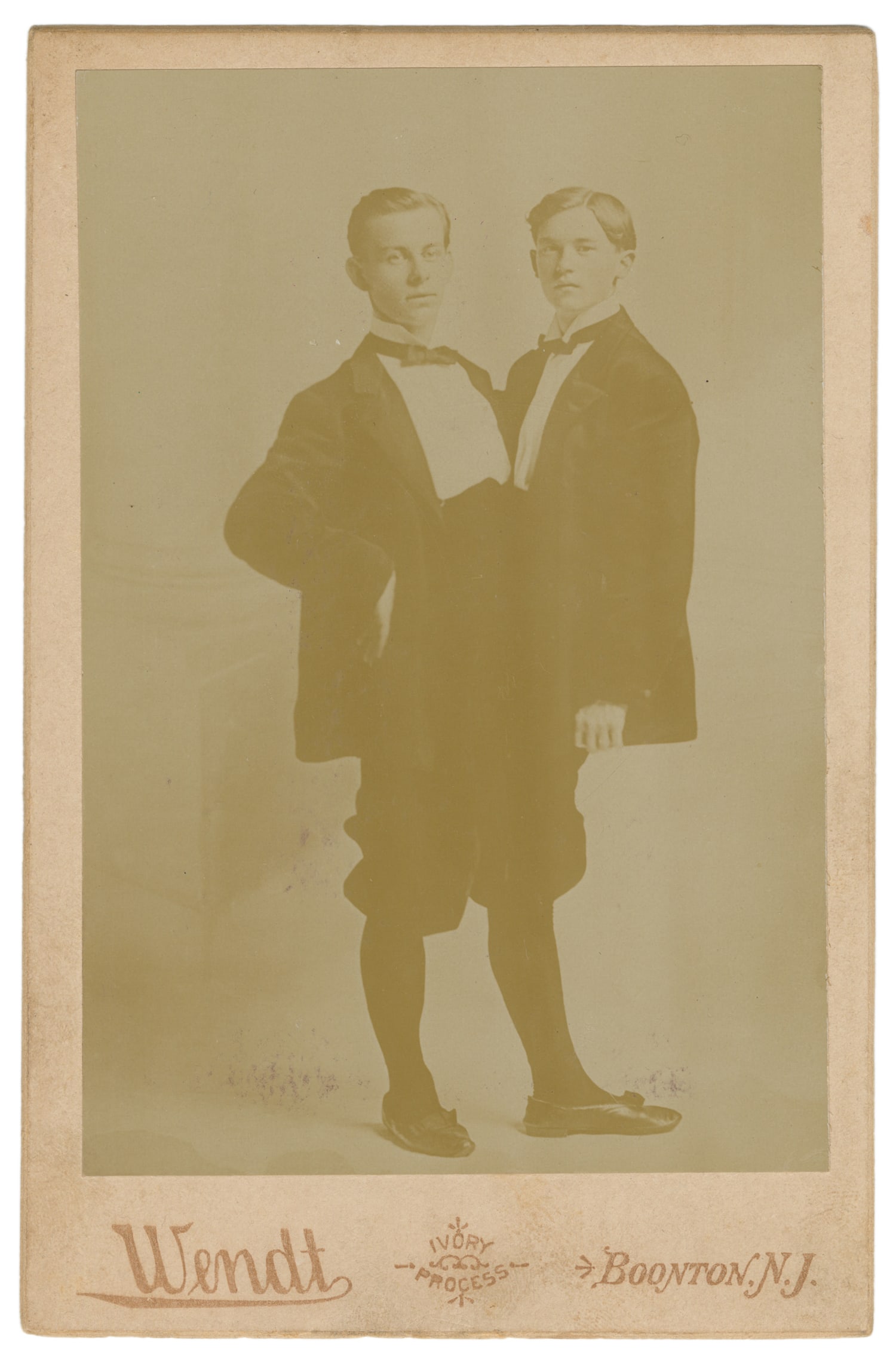 Adolph-Rudolph false Siamese twins cabinet card. (1 of 1)