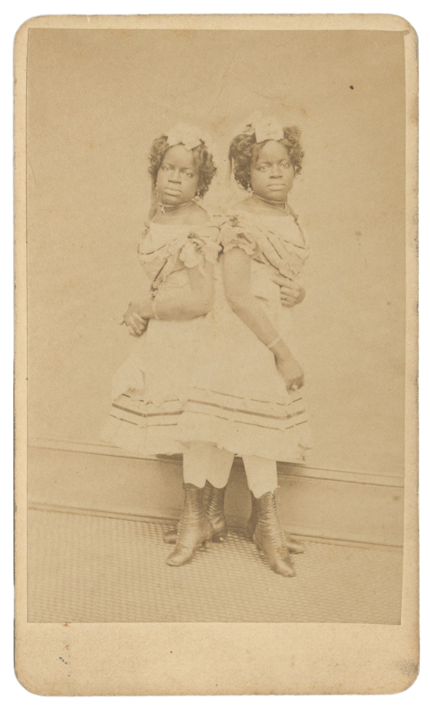 MILLIE-CHRISTINE (Millie and Christine McKoy, 1851-1912). Millie-Christine CDV. 1871. (1 of 1)