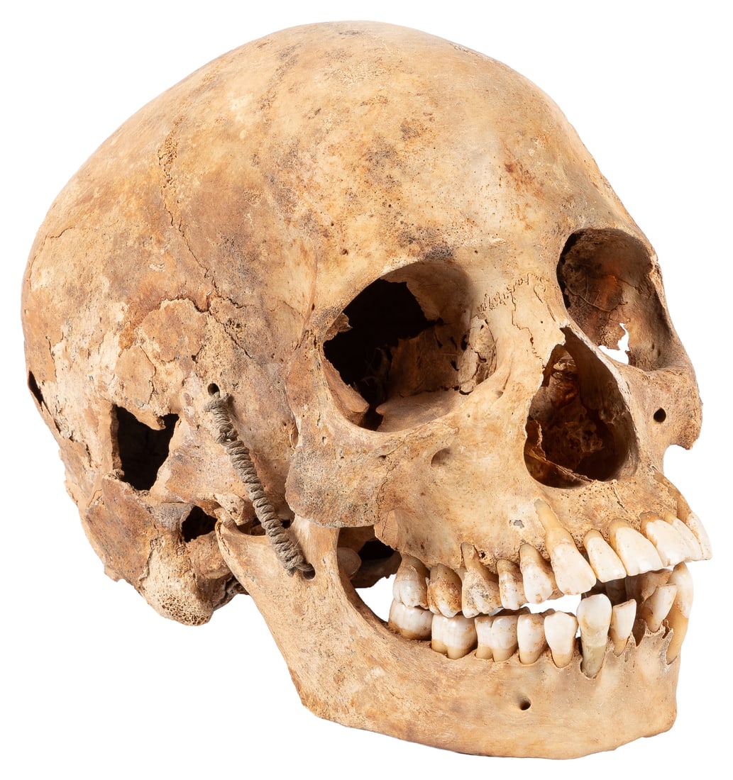 Human skull.: Human skull. A human skull, the jaw held with twine. Retains 28 teeth and one broken tooth. 6 x 4 1/2 x 8".